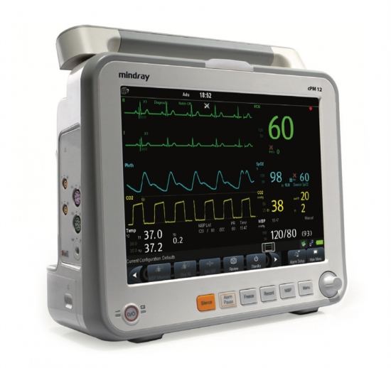 ECG Monitor