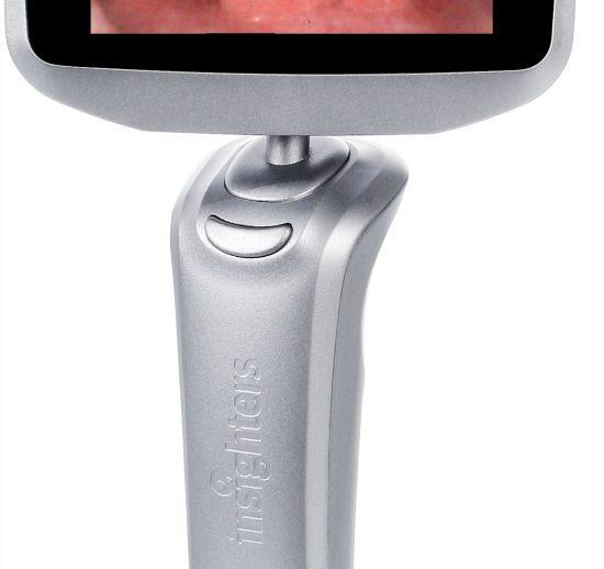 Laryngoscope